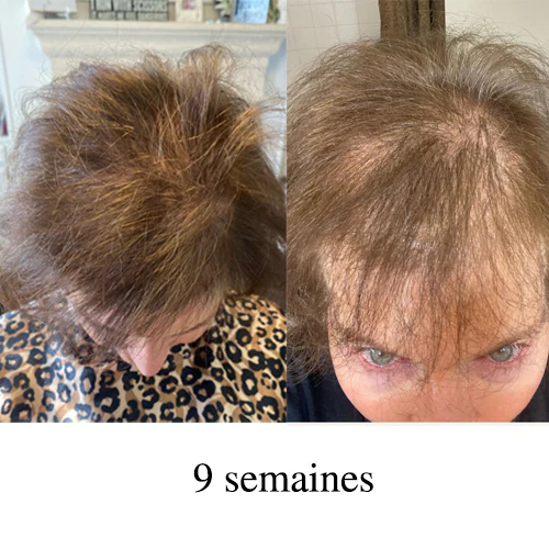 ACTIIV Femme duo voyage shampoing/revitalisant – Image 3